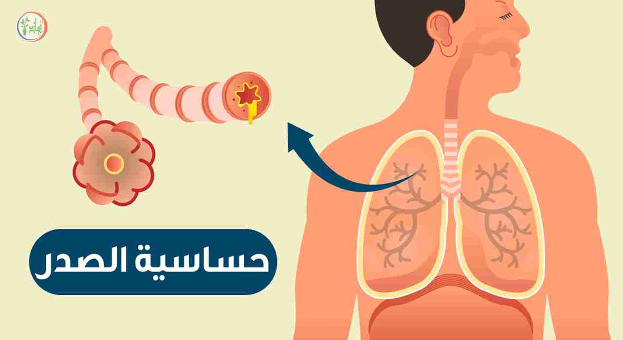 تعرف على العلاقة القوية بين مرض الربو والإنفلونزا