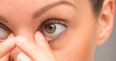 حساسية العين أسبابها وما هي الأعراض الخاصة بها