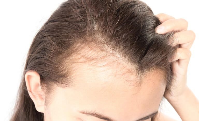 أفضل الحلول للقضاء على الشعر الخفيف