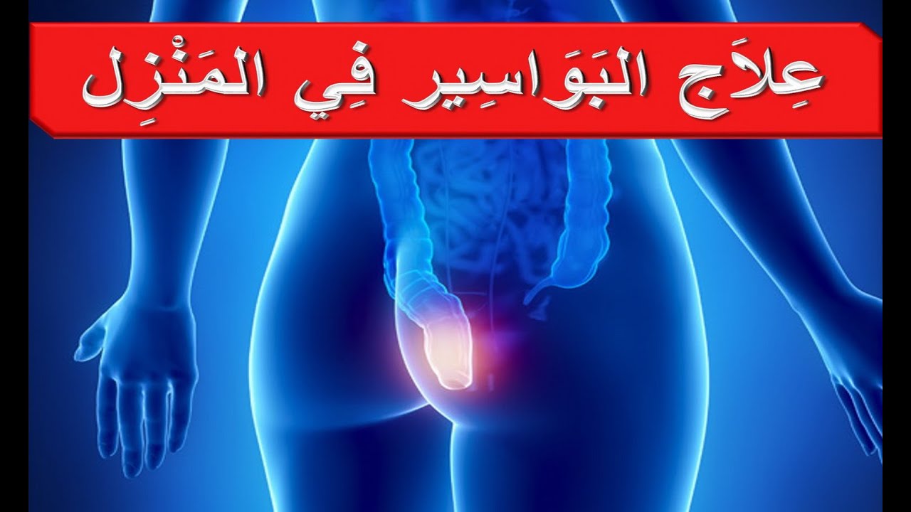 ما هي البواسير وما أعراضها وطرق علاجها وأهم الإرشادات