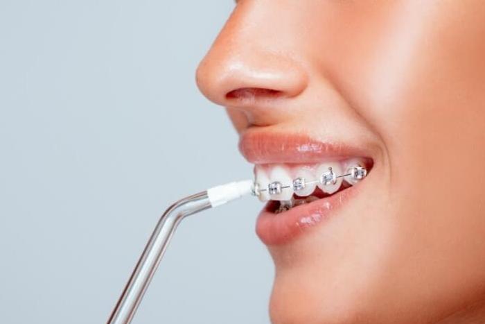 جهاز خيط الاسنان المائي