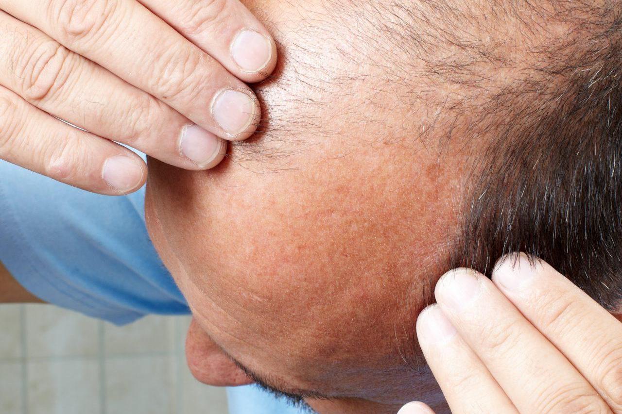 كيفية علاج نفشة الشعر وجفافه خلطات طبيعية للشعر الجاف الناشف