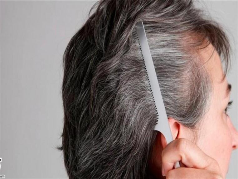 استعيدي شبابك بملعقة قرنفل لإزالة شيب الشعر المبكر نهائياً وبلا رجعة بدون أي أضرار