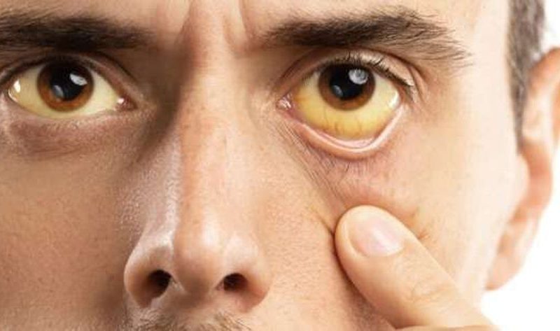 7 أطعمة تساعد على تنقية الكبد من السموم.. تناولها باستمرار – منوعات