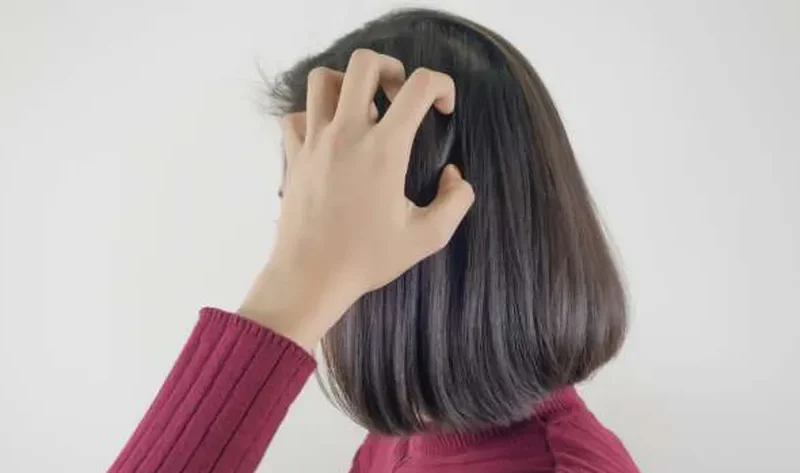 أكلة غير متوقعة تؤدي لزيادة قشرة الشعر في الشتاء.. توقف عنها – منوعات
