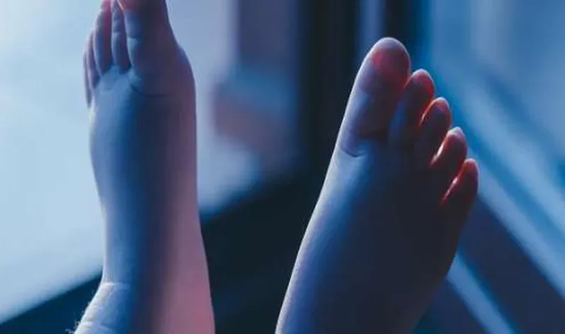 مرض خطير وراء ازرقاق الأطراف.. ليس له علاقة بالبرد – منوعات